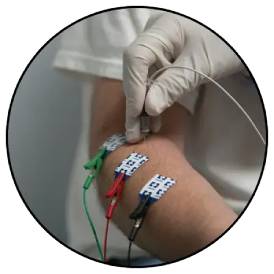 בדיקות EMG