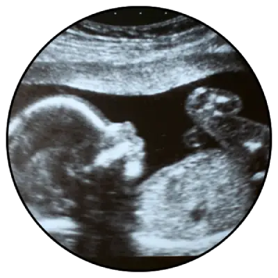 ד"ר יזהר ארז - 3