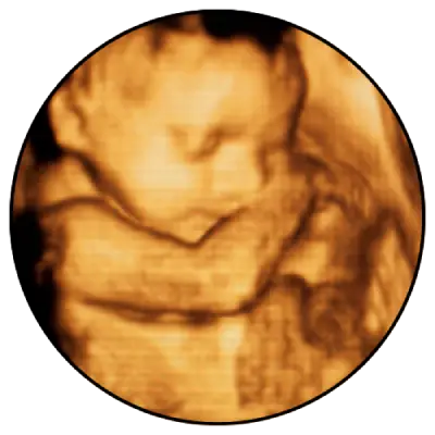 ד"ר יזהר ארז - 5